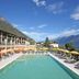 Otros
